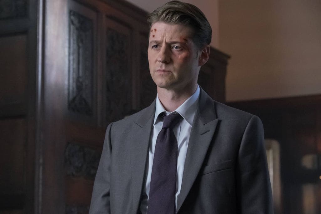 GOTHAM: Ben McKenzie in the "Mad City: Beware the Green-Eyed Monster” GOTHAM: Ben McKenzie in the "Mad City: Beware the Green-Eyed Monster” episode of GOTHAM airing Monday, Nov. 28 (8:00-9:01 PM ET/PT) on FOX. Cr: Jeff Neumann/FOX.